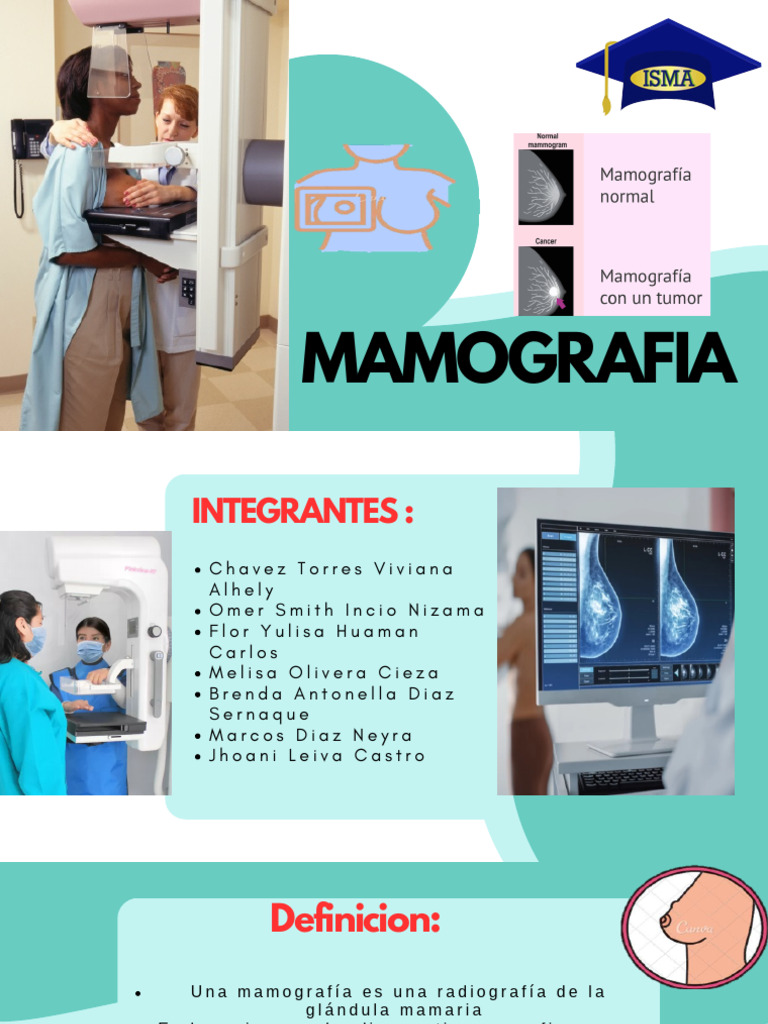 Importancia de la Mamografía | PDF