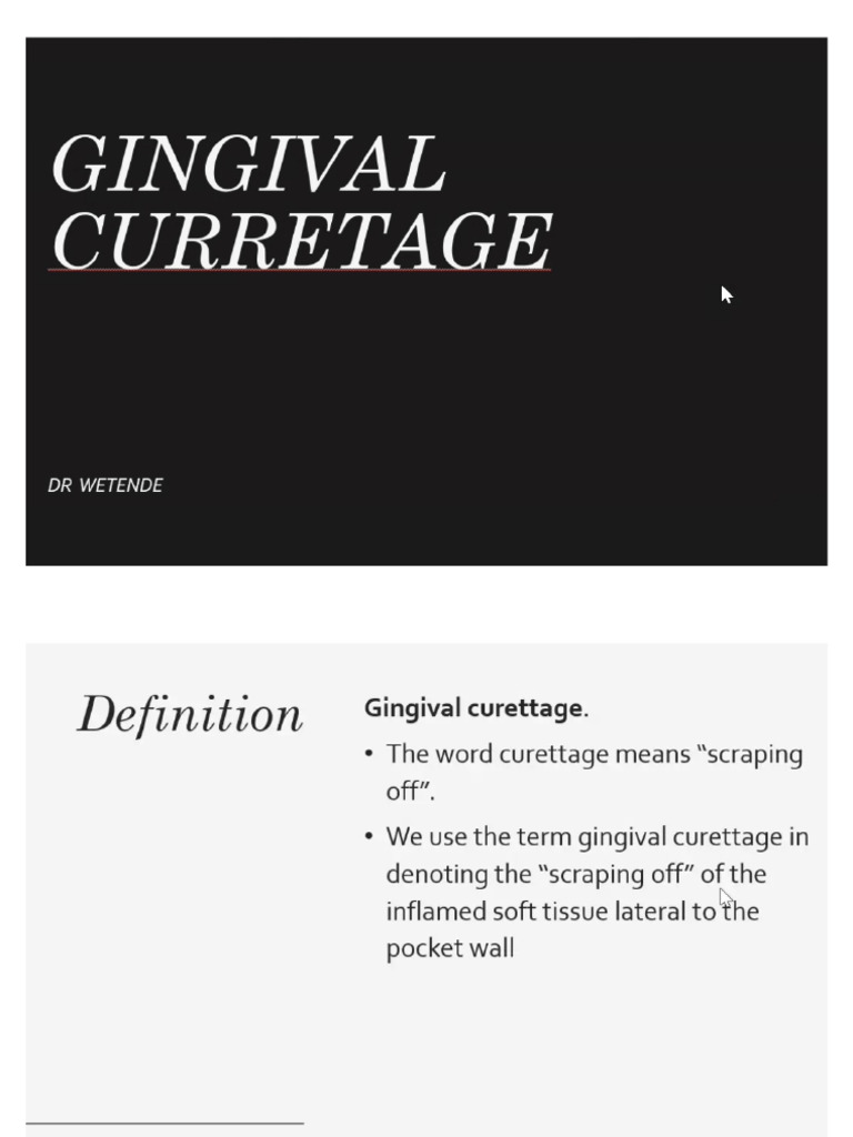 Gingival Curettage PDF