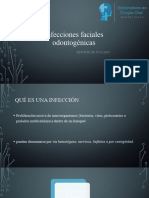 Infecciones Faciales Odontogénicas