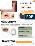 Cojuntivitis