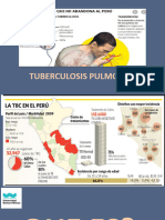 Tuberculosis Pulmonar