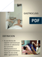 Gastroclisis