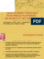 Chest Angioscanner Thoracique Pour Embolie Pulmonaire