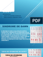 Caso I Sindrome de Down Par 21