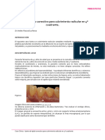 Perioexpertise-Caso-Clinico-13-Caso Clinico - Injerto de Tejido Conectivo para Cubrimiento Radicular en 4o Cuadrante
