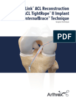 Graftlink Acl Reconstruction With Acl Tightrope II Implant For Internalbrace Technique