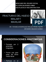 Fracturas de Maxilar y Malar