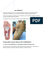 Fibromatose Plantar (Doença de Ledderhose) Saiba Tudo