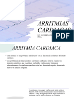 Arritmias Cardiacas