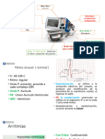 Arritmias Desfibriladores