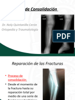 Tema 14 Trastornos de Consolidación