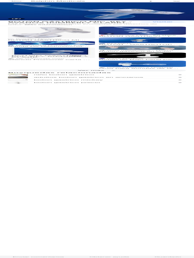 Searchq boton gastrico en adultos tbm isch hl es prmd isvn rlz 1cdgoyi