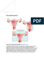 Histerectomía Abdominal