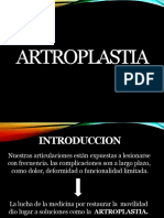 ARTROPLASTIA