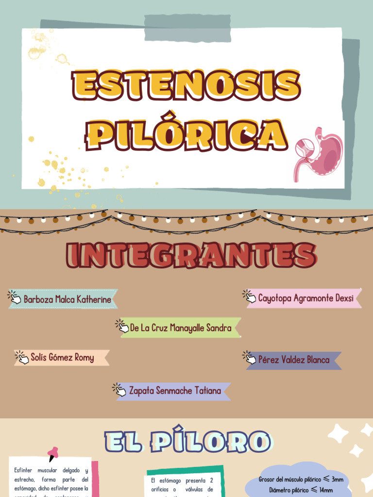 Estenosis Pilórica | PDF | Estómago | La matriz extracelular