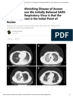 A Radiation-Mimicking Disease of Access - We Initially Believed SARS-CoV-2 Was A Respiratory Virus Is That The Respiratory Tract Is The Initial Point of Access