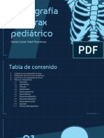 Vidal Hinostroza, Daniel Lionel - Radiografía Del Tórax Pediátrio