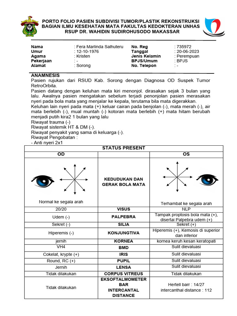 Tumor Retroorbita pada Pasien Mata | PDF