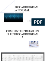 ELECTROCARDIOGRAMA NORMAL - PPTM