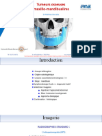 Tumeurs Maxillo-Mandibulaires