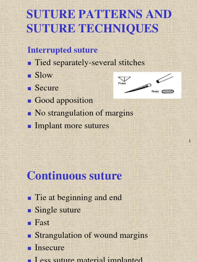 Suture Patterns and Techniques Overview | PDF | Surgical Suture ...