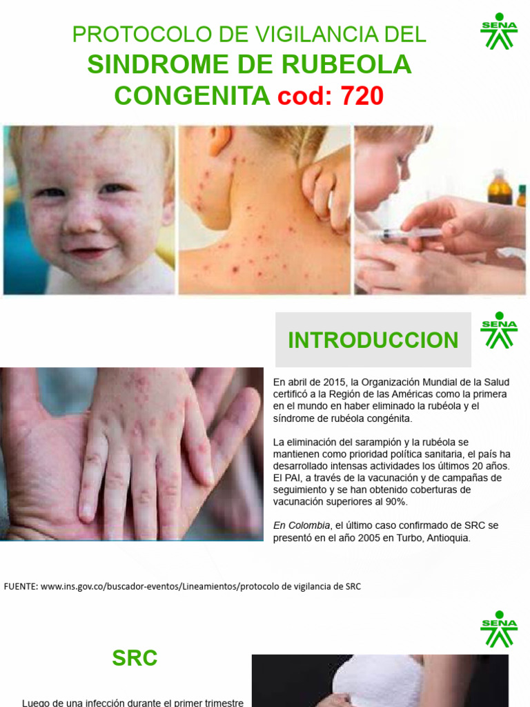 Sindrome de Rubeola Congenita | PDF | Laboratorios | Vigilancia
