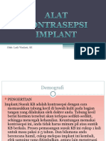 Matri Kie Implant
