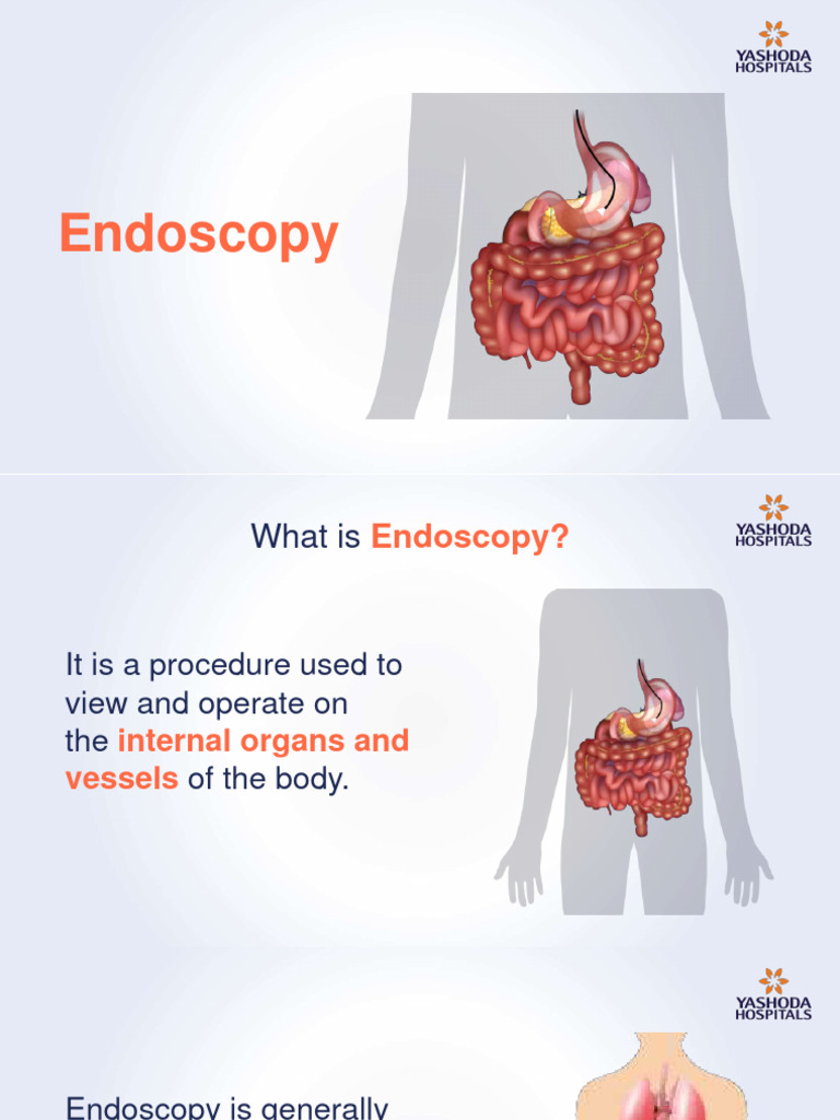 Endoscopy 190724124710 PDF Endoscopy Medical Procedures