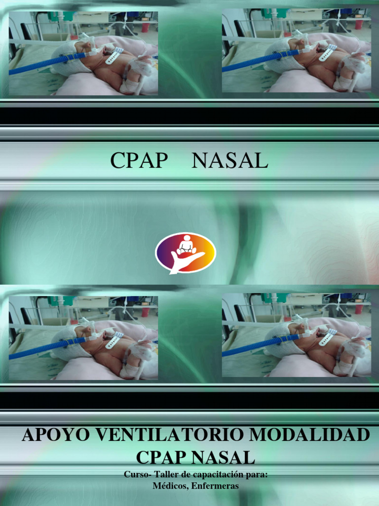 Cpap Nasal | PDF