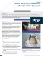 2014 - Precision Attachments For Aesthetics and Function. A Case Report