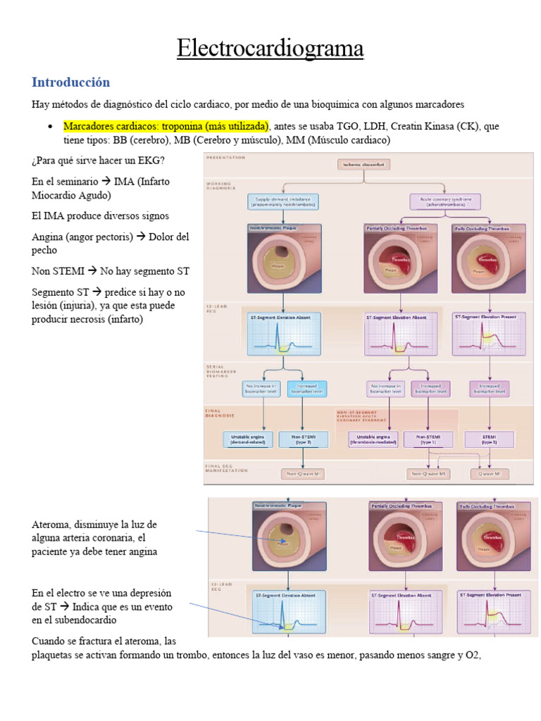 Electrocardiograma (EKG) | PDF | Electrocardiografia | Infarto de miocardio