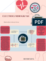 Electro Cardiograma