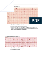 G1a119115 Dilfa Alamanda Tugas SL Ekg