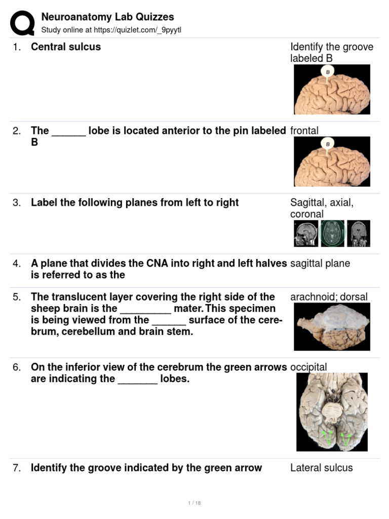Neuroanatomy Lab Quizzes PDF