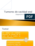 Tumores de Cavidad Oral