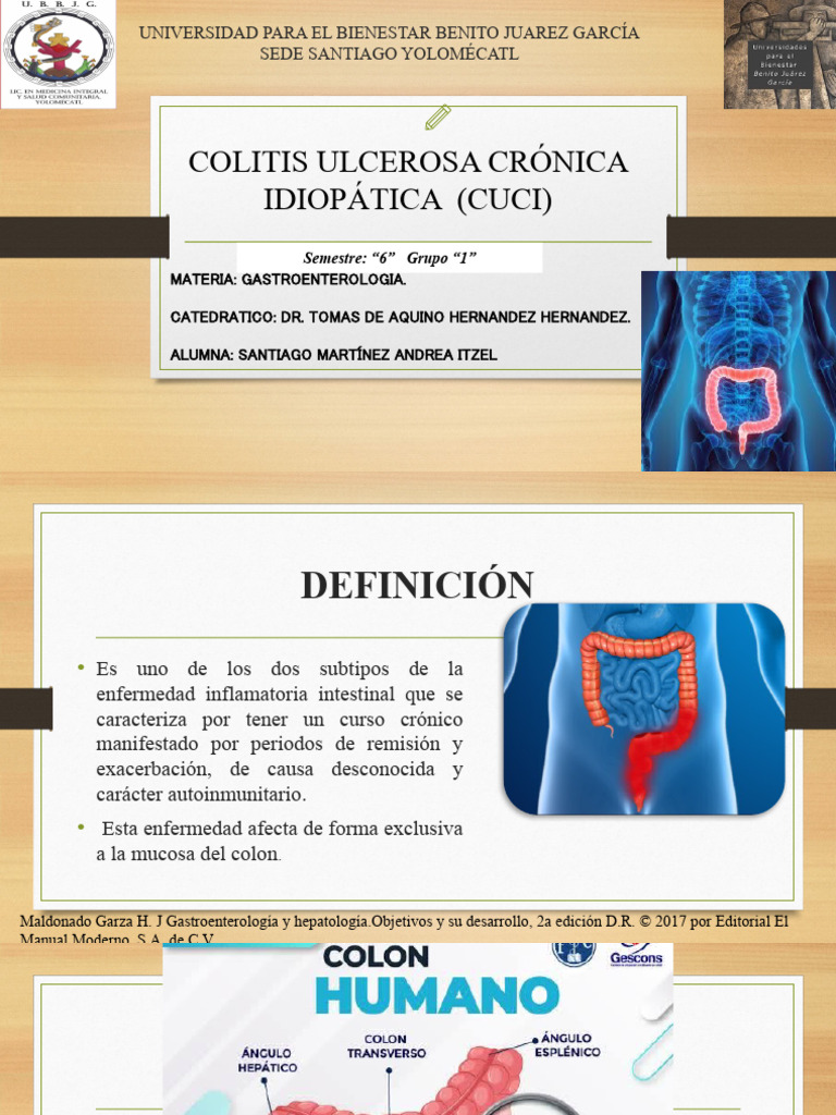 Colitis Ulcerosa Crónica: Diagnóstico y Tratamiento | PDF | Enfermedad ...