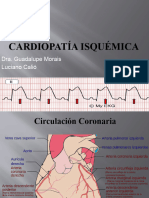 Cardiopatía Isquémica