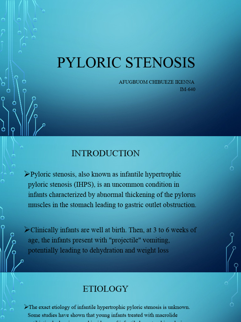 pyloric-stenosis-chibueze-pdf-digestive-system-medicine