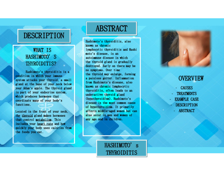 Hashimoto's Thyroiditis Guide | PDF | Wellness