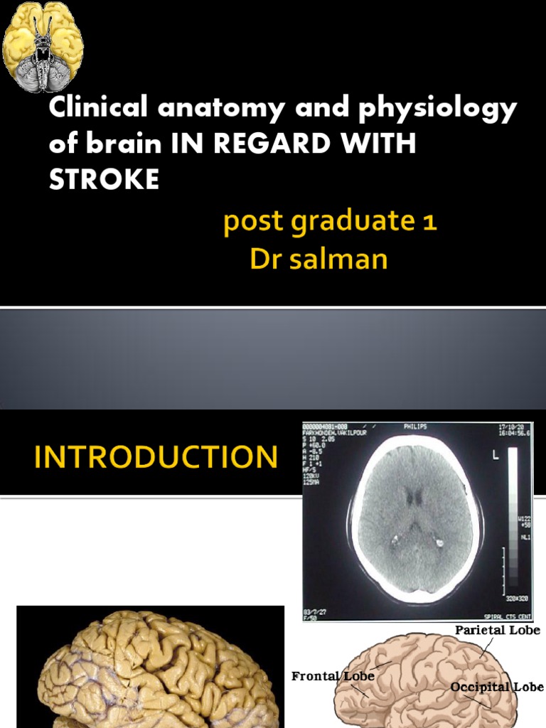 Brain Anatomy and Stroke Physiology | PDF | Cerebral Cortex | Cerebrum
