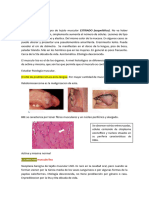 DX Diferencial 3r Parcail