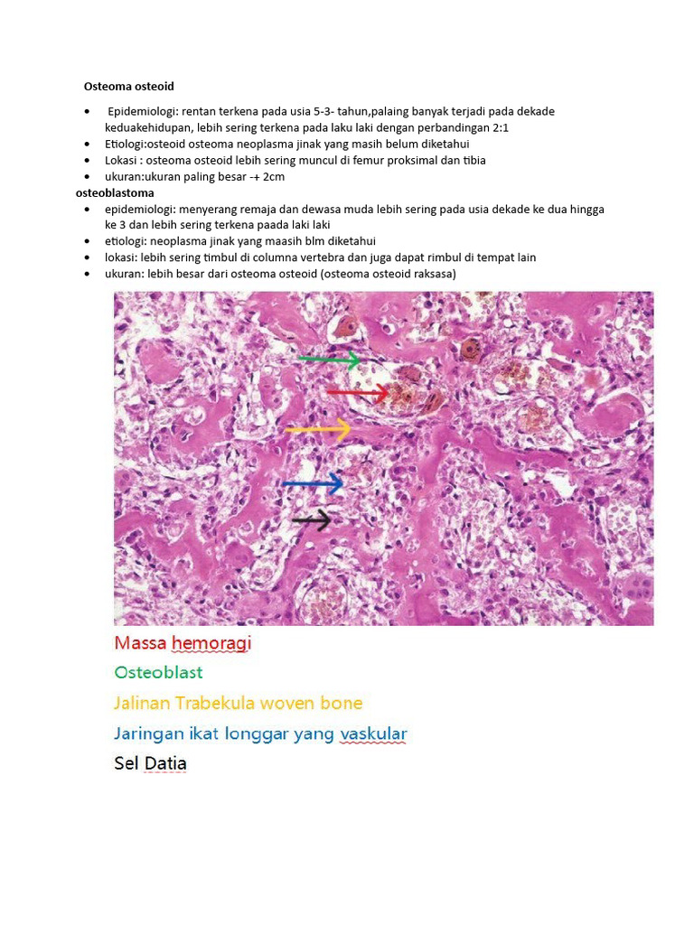 Osteoma osteoid | PDF