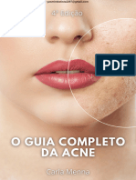 Guia Completo Da Acne Carla Menna