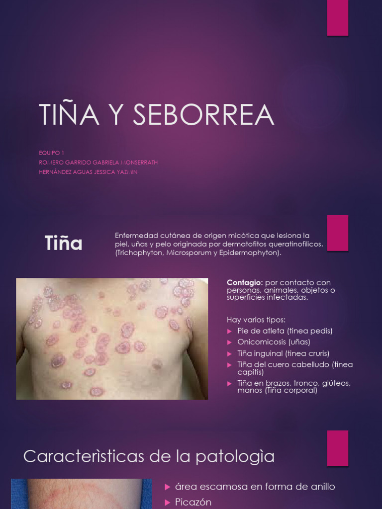 Tiña y Seborrea: Causas y Tratamientos | PDF | Ciencia y matemáticas