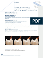 The Simultaneous Modeling Technique Closing Gaps in Posteriors