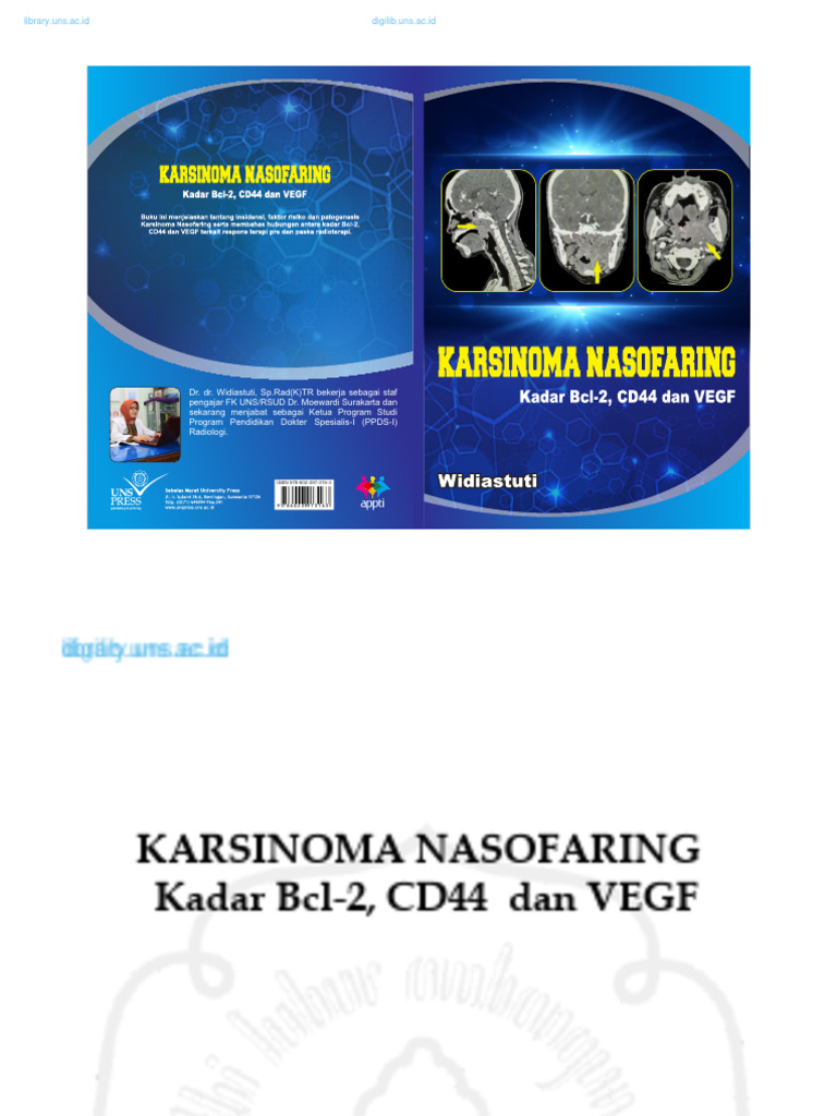 Karsinoma Nasofaring | PDF