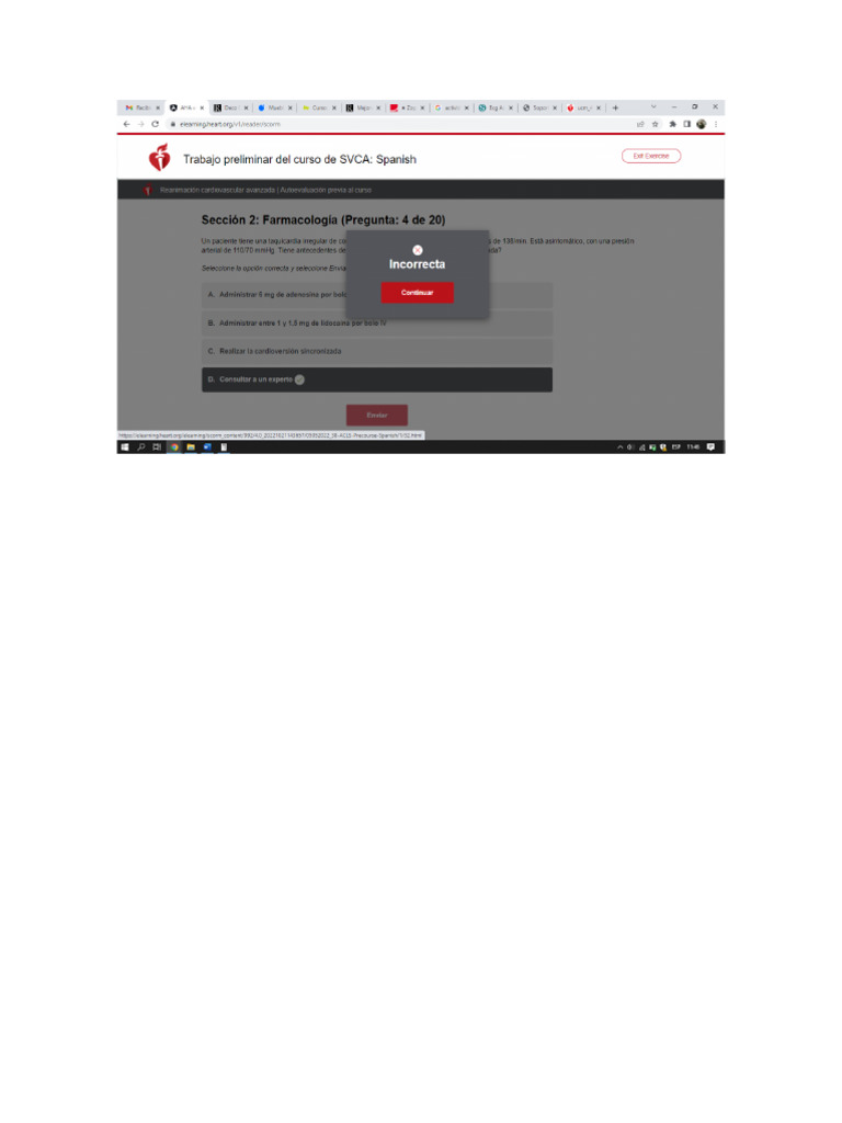 Acls Pretest | PDF