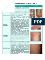 Lesiones Dermatológicas Por Covid 19: Nombre Características Imagen