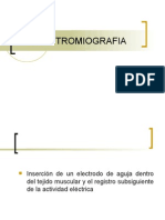 ELECTROMIOGRAFIA