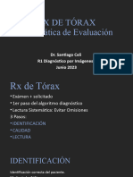 RX Tórax Sistematica de Evaluación